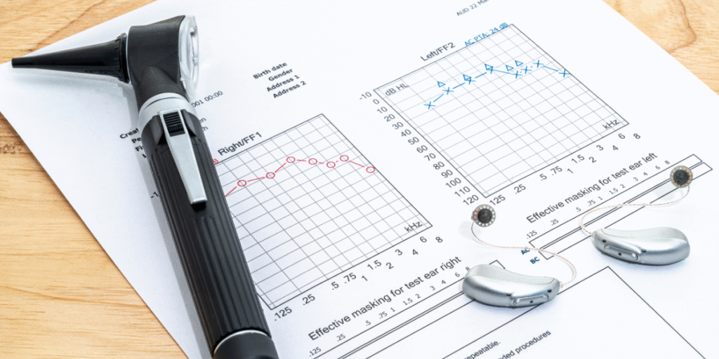 How to Read an Audiogram
