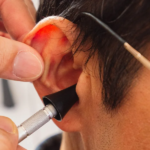 How Much Does Tinnitus Treatment Cost in Australia